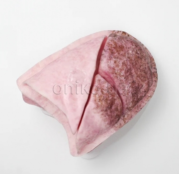 Full Replacement Lung for Video-Assisted Thoracoscopic Surgery Trainer
