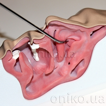 Otolaryngology