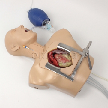 Extracorporeal Membrane Oxygenation