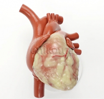 Non-Patent Heart