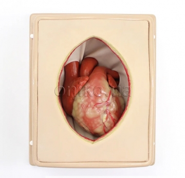 Suitcase Thorax