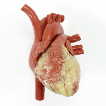 Cardiology