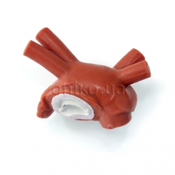 Normal Mitral Valve without Chordae and Papillary Muscles
