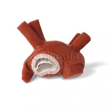 Fluoroscopic Heart