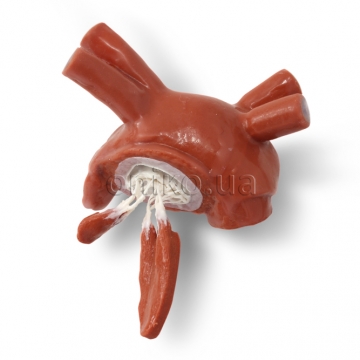 Prolapsed Mitral Valve with Chordae and Papillary Muscles