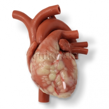Minimally Invasive Cardiac Surgery Mitral and Coronary Artery Bypass Graft Beating Heart with Ancillary Components