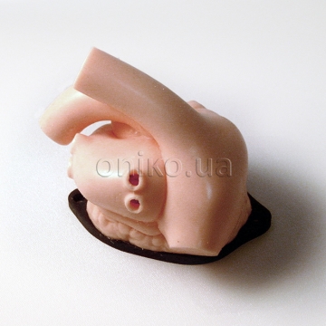 Mitral Valve with Atria