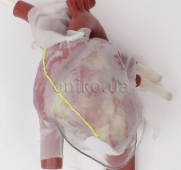 Pericardium with Pleura