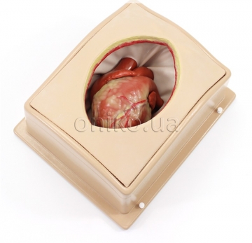 Suitcase Thorax