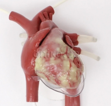 Trauma Thoracotomy Beating Heart with Wound