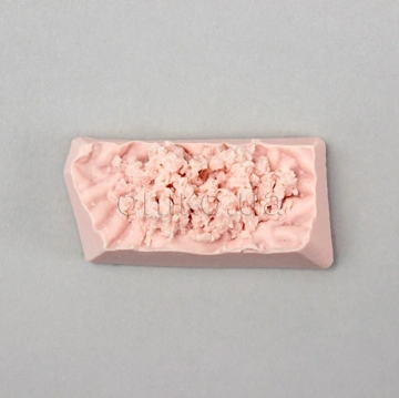 Stomach Biopsy Disc Tissue