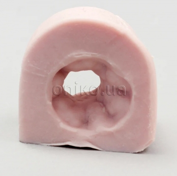 Colonic Stricture Tissue