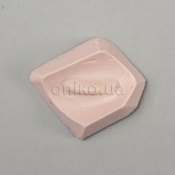 Esophageal Varix Tissue