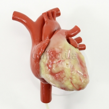 Coronary Artery Bypass Graft Beating Heart Trainer with Ancillary Components