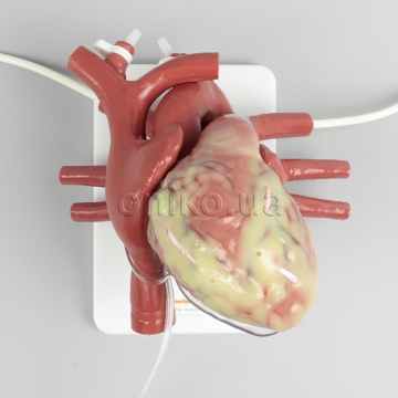 ECMO Cannulatable Beating Heart Trainer