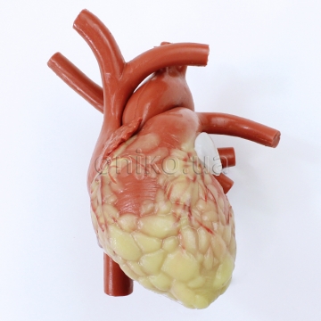 Heart with Replaceable Left Atrial Appendage