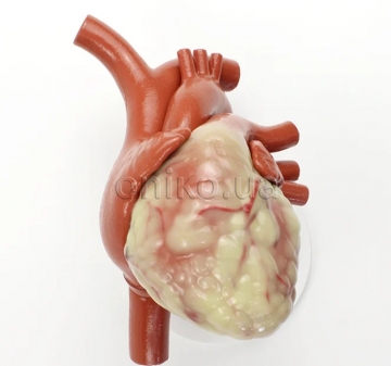 Non-Patented Heart Model