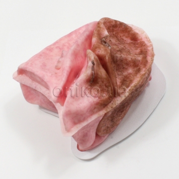VATS Trainer for Explant