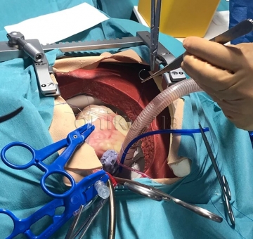 High-Fidelity Cardiothoracic Surgical Trainer
