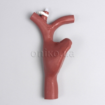 ECMO Cannulatable Right Atrium