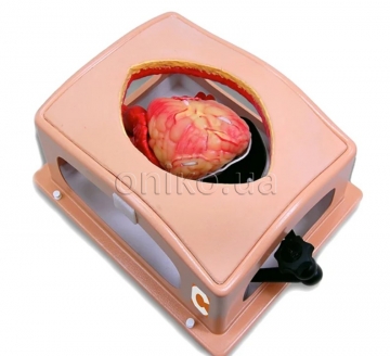 Heart Case