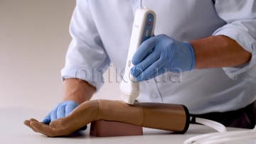 Артеріальна пункція зап'ястя – УЗД